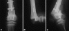 Fig. 4A–C