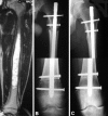 Fig. 2A–C