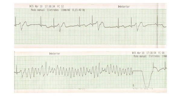 Figure 2A