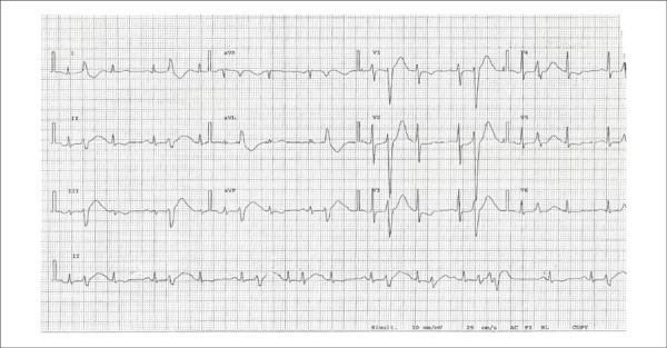 Figure 2B