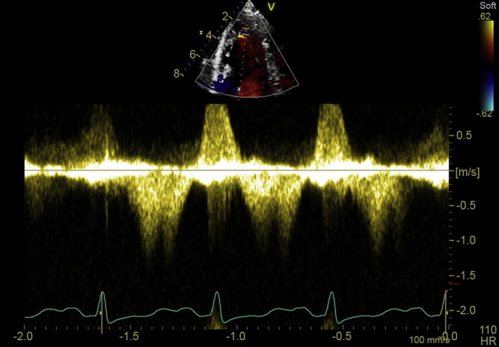 Figure 3