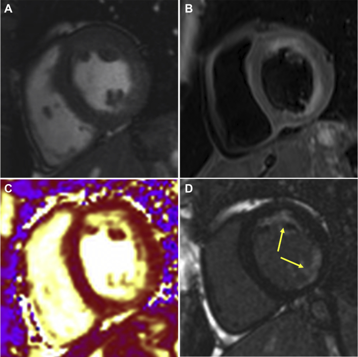 Figure 2