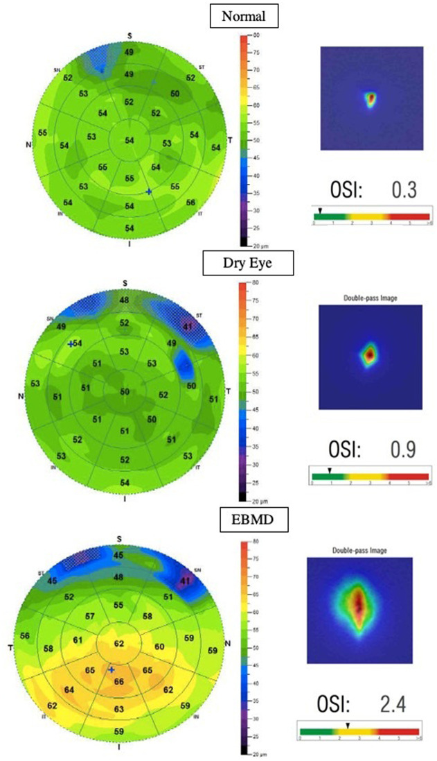 Fig 3