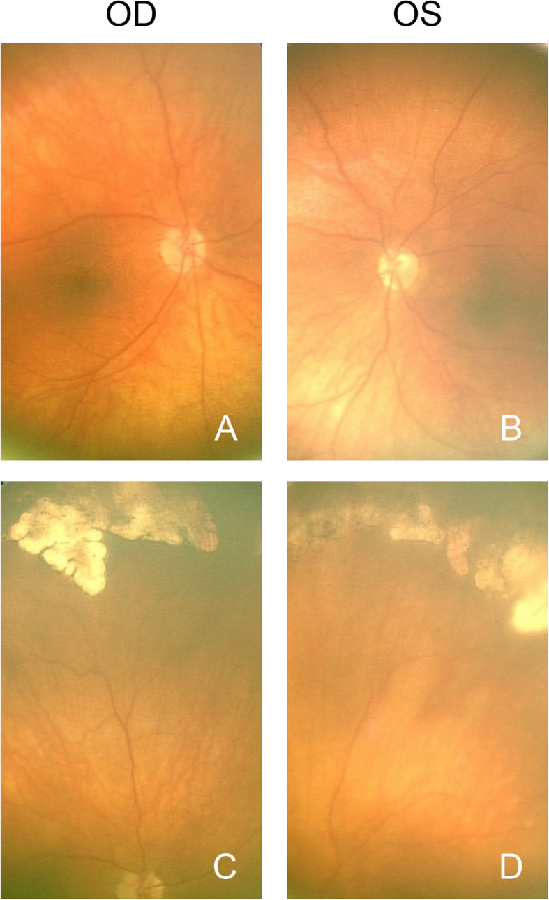 Fig. 1