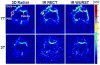 Fig. 12