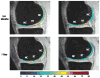 Fig. 13