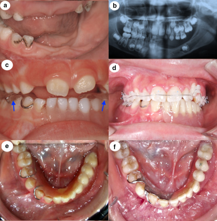 Fig. 2