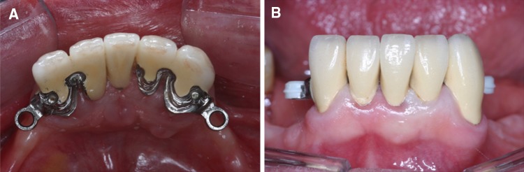 Fig. 6