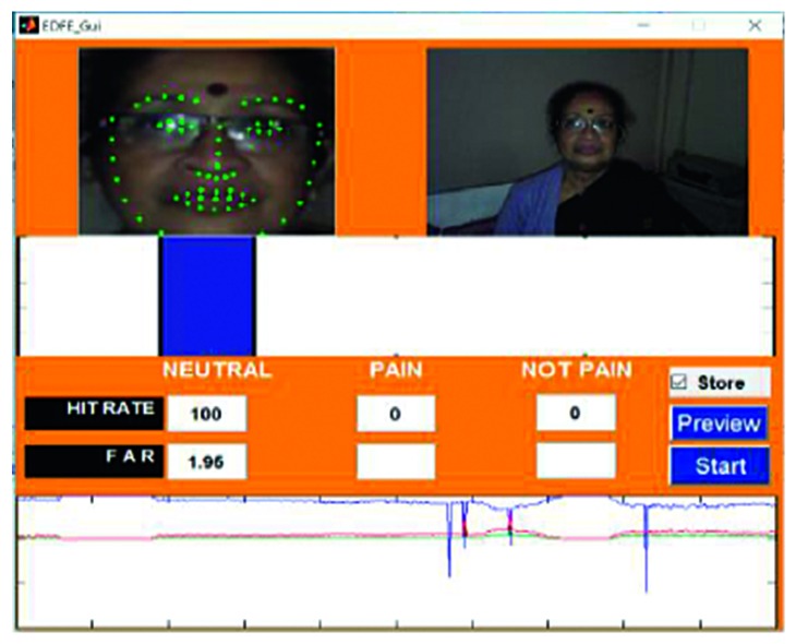 Figure 16