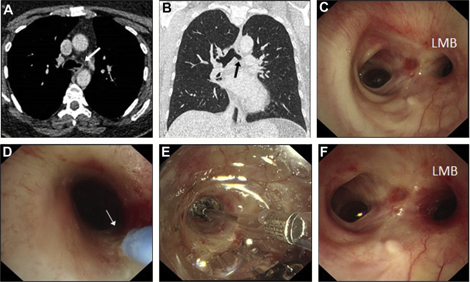 Fig. 10.