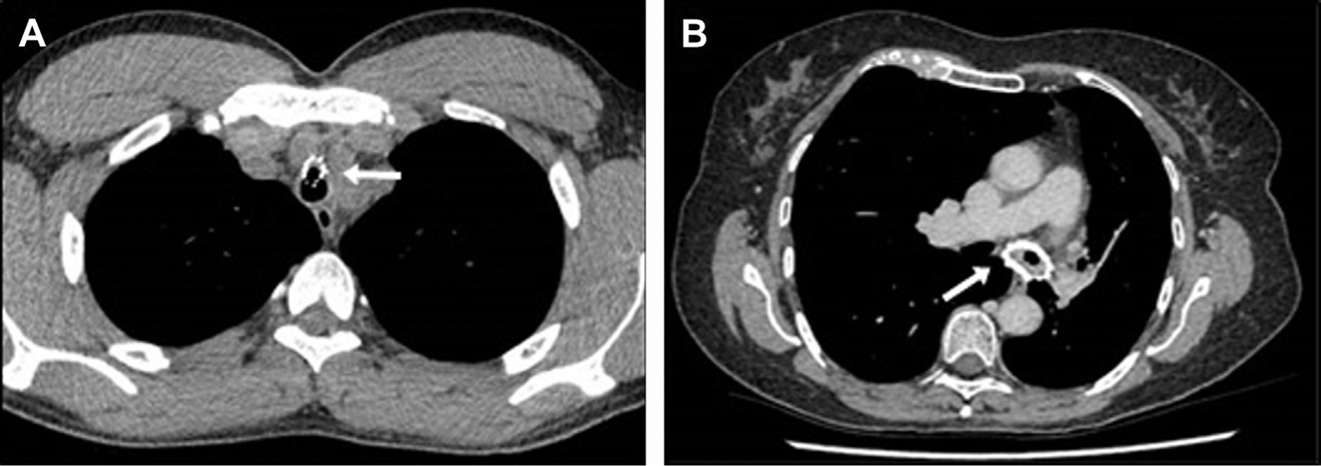 Fig. 12.