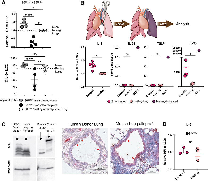 ILC2 activation by ischemia-reperfusion injury-induced IL-33.