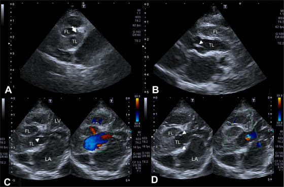 FIGURE 2