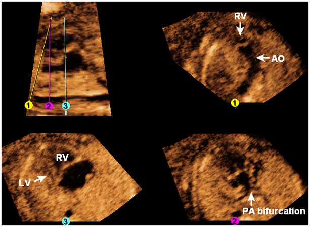 Figure 12