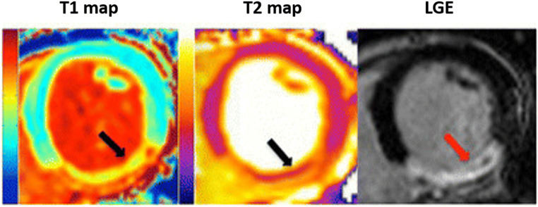 Fig. 2