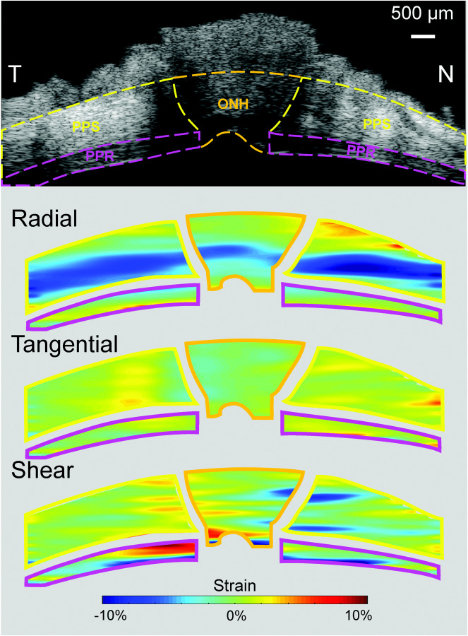 Radial, tangential, and shear strain maps of PPR, ONH, and PPS from a representative eye at 30 mmHg