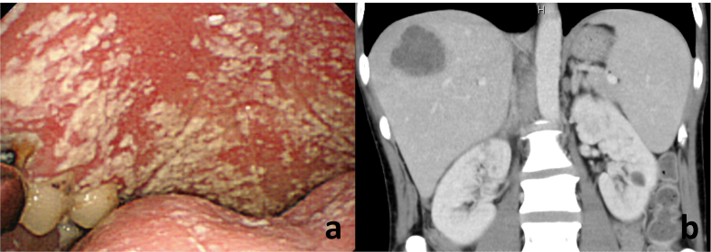 Fig. 1