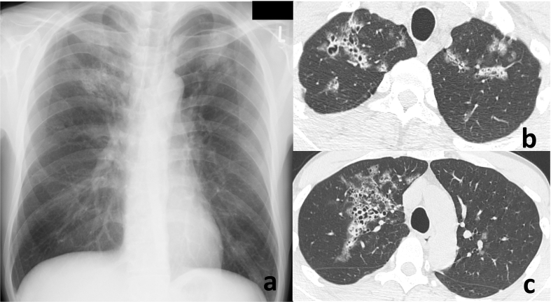 Fig. 2