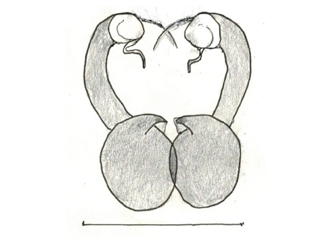 Figure 18e.