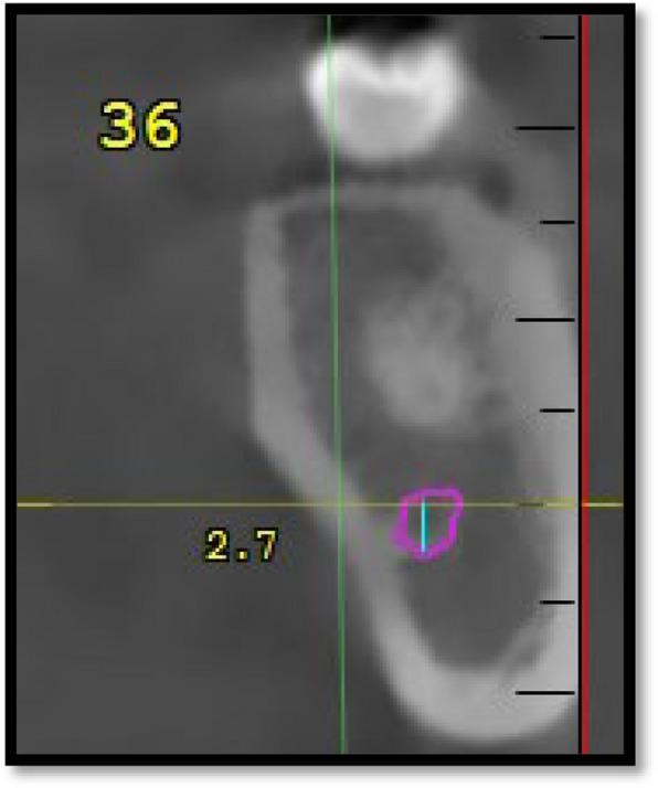 Fig. 1