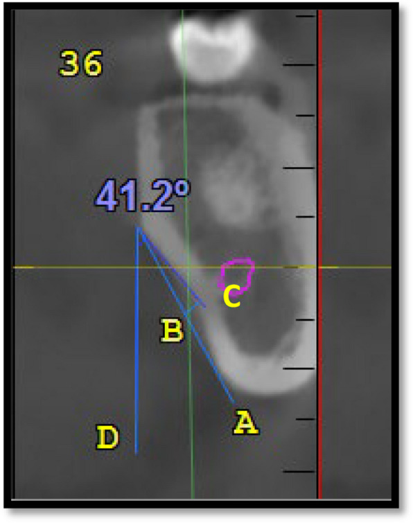 Fig. 4