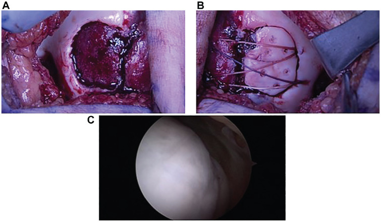 Figure 2.