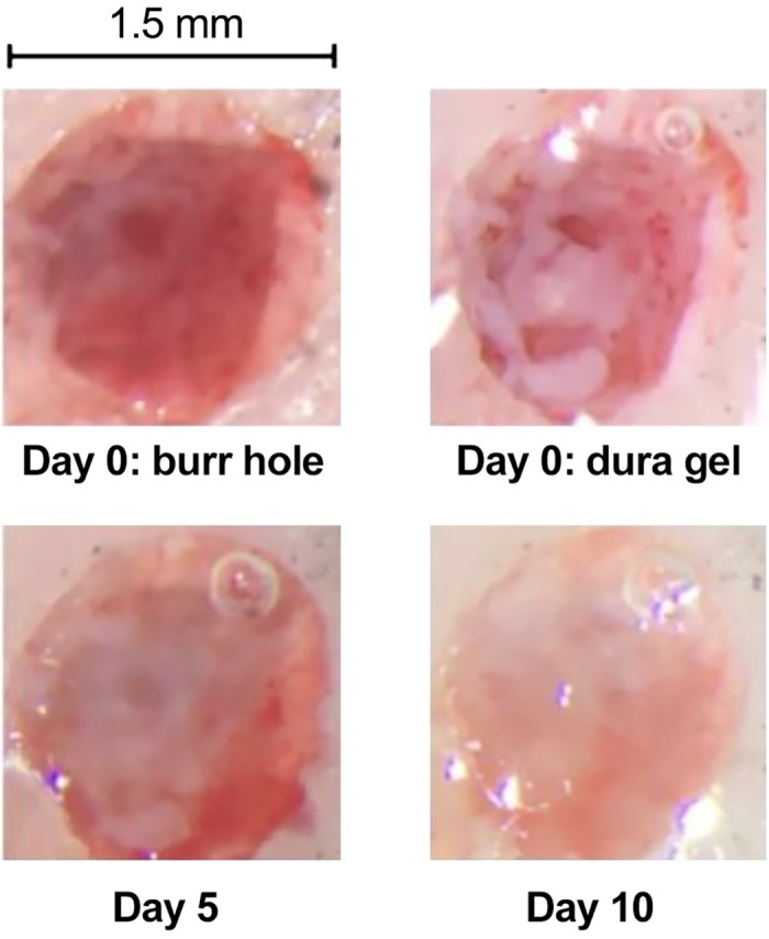 Fig. 11.