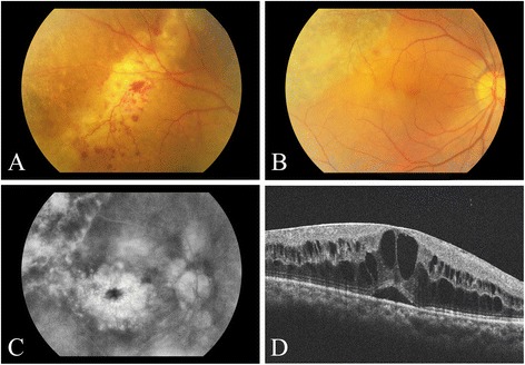 Fig. 1