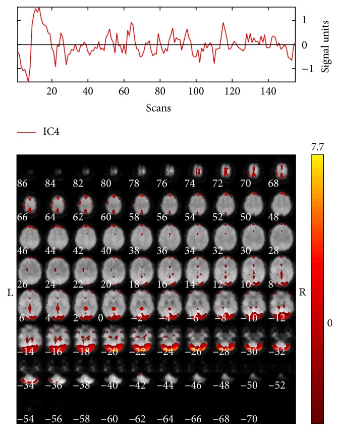 Figure 4