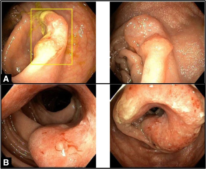 Fig. 1