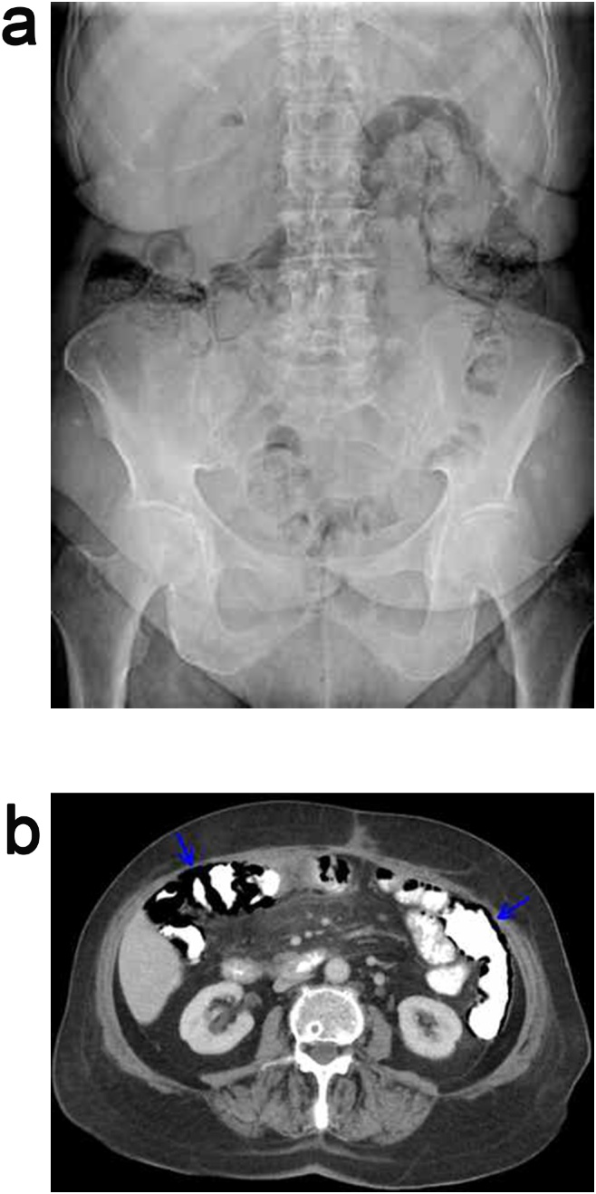 Fig. 1