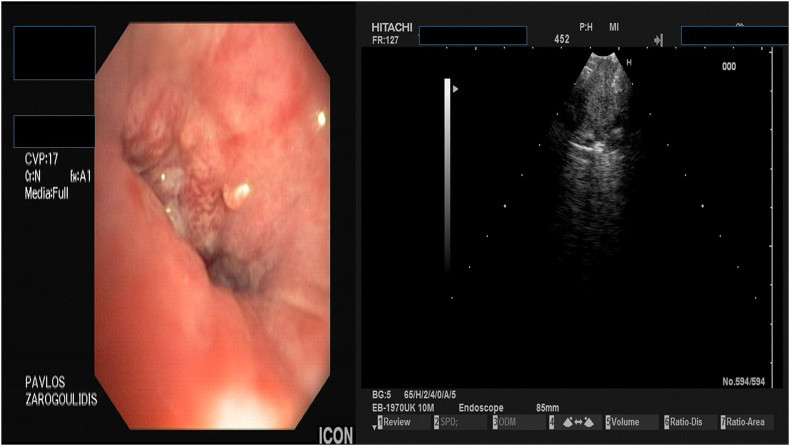 Fig. 2