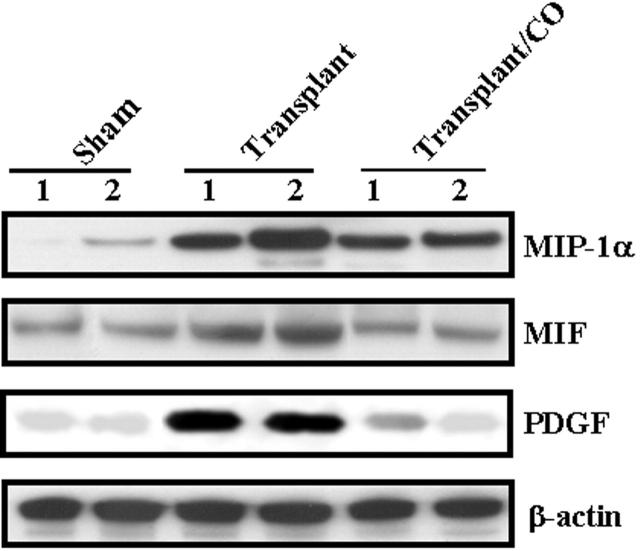 Figure 11.