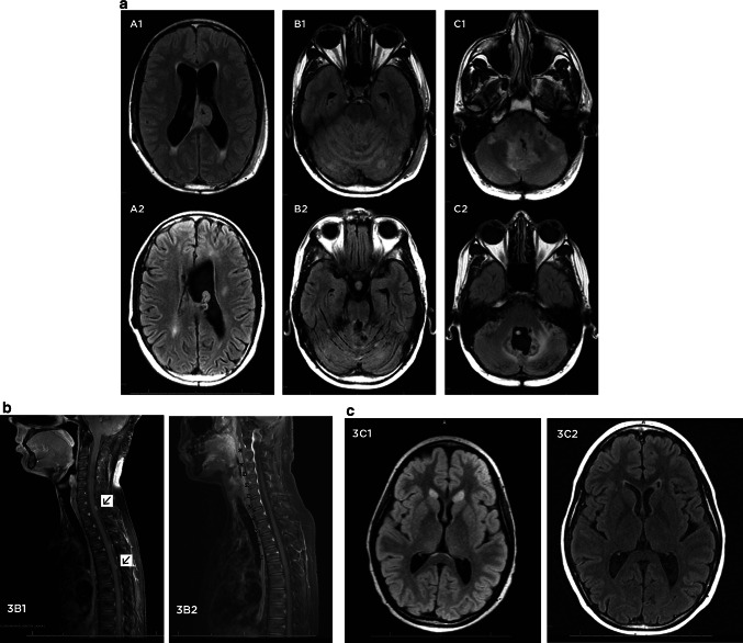 Fig. 3