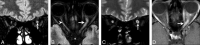 Fig 3.