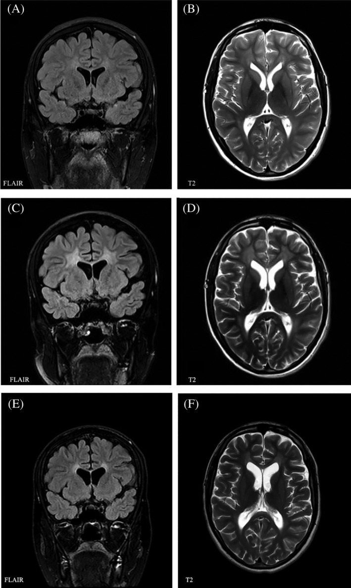 FIGURE 2