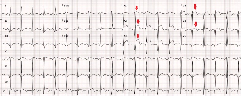 Fig 3