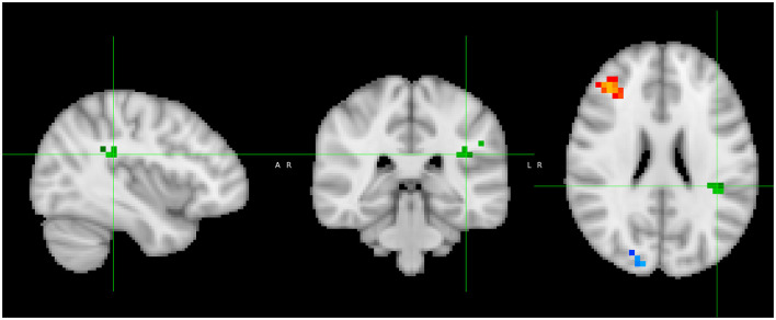 Figure 5