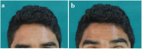 [Table/Fig-4]: