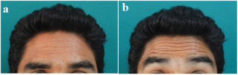 [Table/Fig-2]: