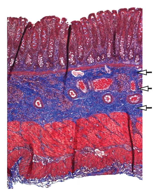 Figure 4b: