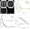 Representative short repetition time (TR) adiabatic inversion recovery–prepared ultrashort echo time brain images (TR = 140 msec) in a healthy volunteer (29-year-old woman) with echo times (TEs) of, A, 0.032 msec, B, 0.1 msec, C, 0.3 msec, and, D, 2.2 msec. The magnitude and real and imaginary parts of mean signal intensity with different TEs of a region of interest (green oval in A) are plotted in E. F, Exponential fitting of magnitude signals at different TEs shows a short T2* of 0.22 ± 0.01 msec in this region of white matter. G, Linear fitting of phase signals with TE (R2 = 0.98) clearly demonstrates a chemical shift of detected myelin signals. a.u. = arbitrary units.