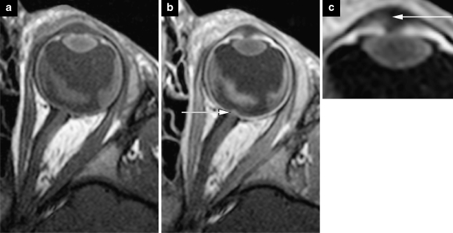 Fig. 11