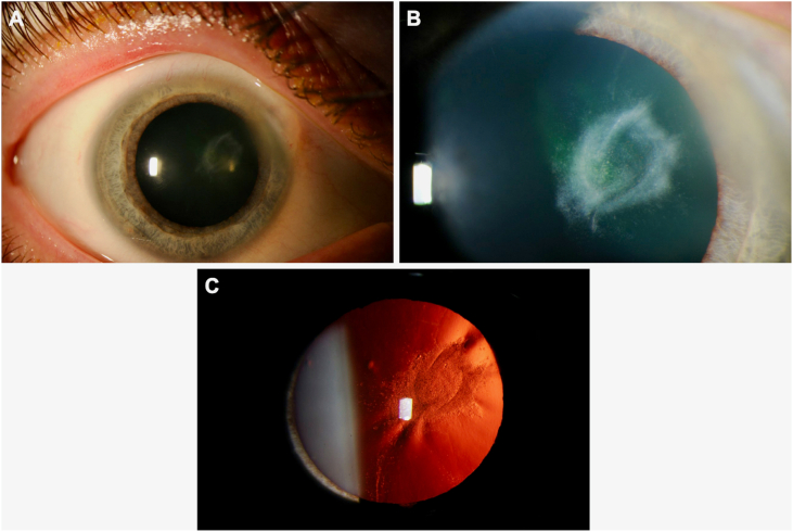 Fig. 2