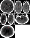 FIG. 2.