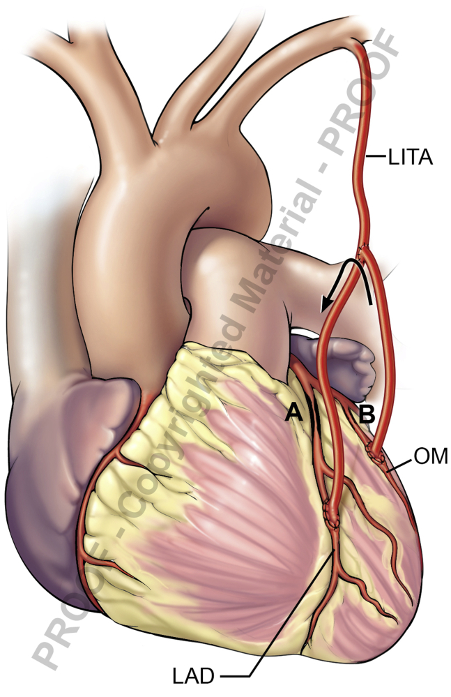 Figure 4