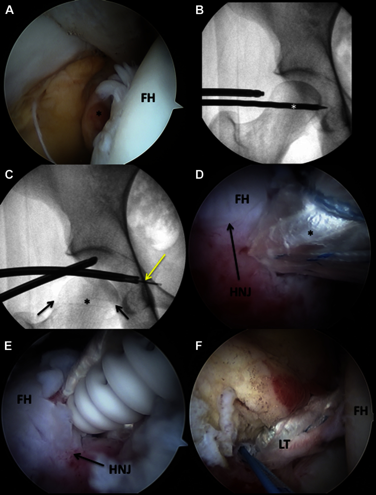 Fig 2