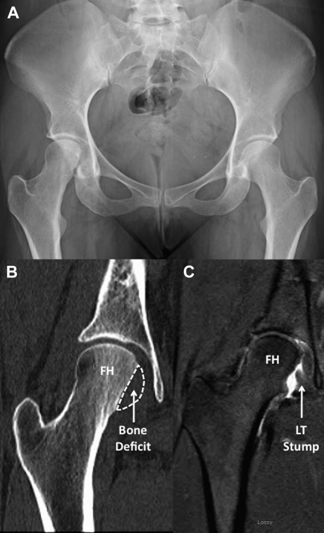 Fig 1