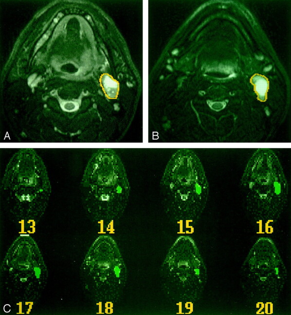 Fig 2.