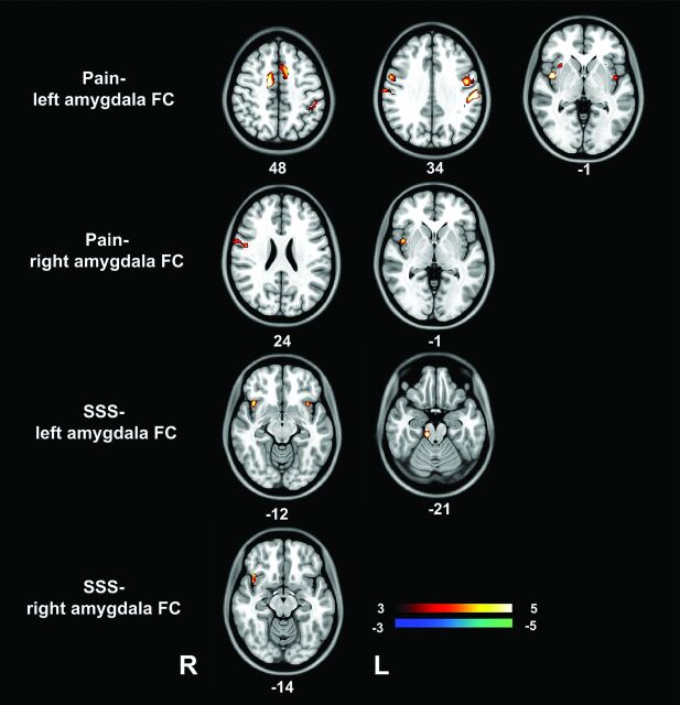 Fig 3.